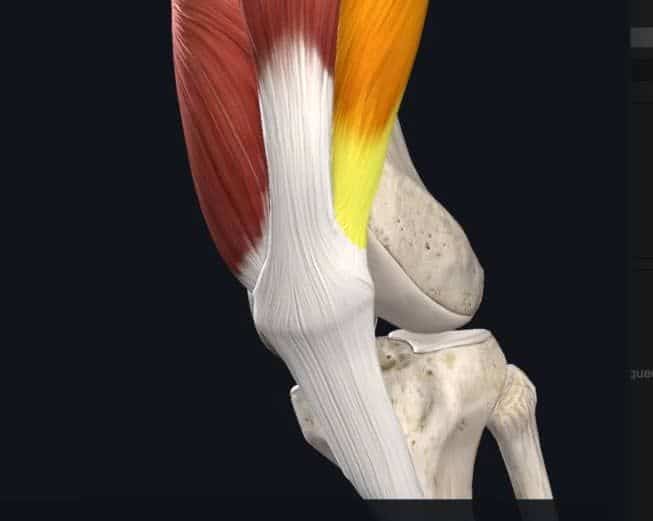 Completo articular de la rodilla y cuádripceps imiplicado en la condromalacia rotuliana - Clínicas H3