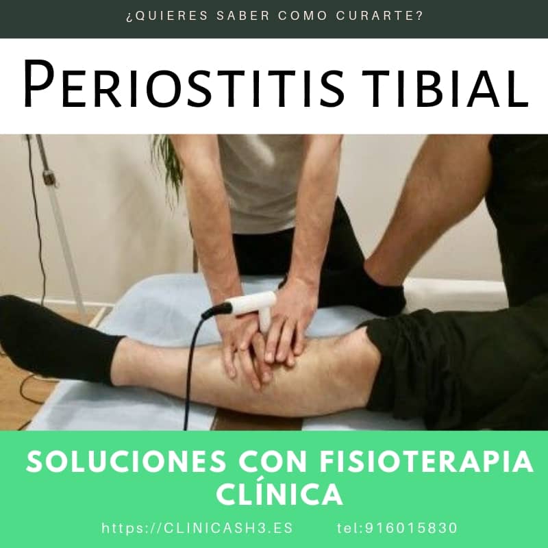 Periostitis tibial anterior en fisioterapia Clínicas H3 Madrid