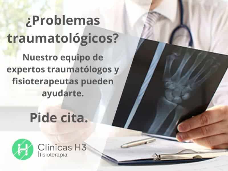 Servicio de traumatólogo privado Madrid en Clínicas H3 PEdir cita