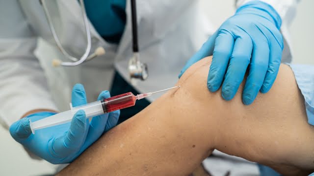 Vista en primer plano de un especialista de Clínicas H3 Serrano realizando una infiltración de Plasma Rico en Plaquetas (PRP) en la rodilla de un paciente.
