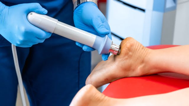Fisioterapeuta aplicando ondas de choque para tratar fascitis plantar en Clínicas H3 Serrano